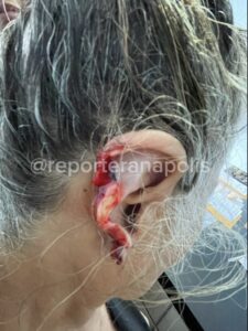 VÍDEO: NETO É PRESO APÓS ARRANCAR, MASTIGAR E ENGOLIR PARTE DA ORELHA DA AVÓ DE 73 ANOS EM ANÁPOLIS